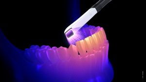 Eine stilisierte Darstellung wie ein Intraoralscanner einen Unterkiefer als Datensatz abbildet
